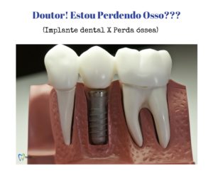 Doutor! Estou perdendo osso!!!