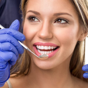 Facetas Dentárias