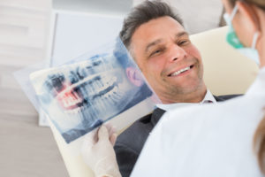 Exodontia (extração de dentes), Exodontia de dentes impactados, Remoção de dente do siso