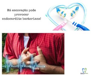 Má escovação pode causar endocardite bacteriana
