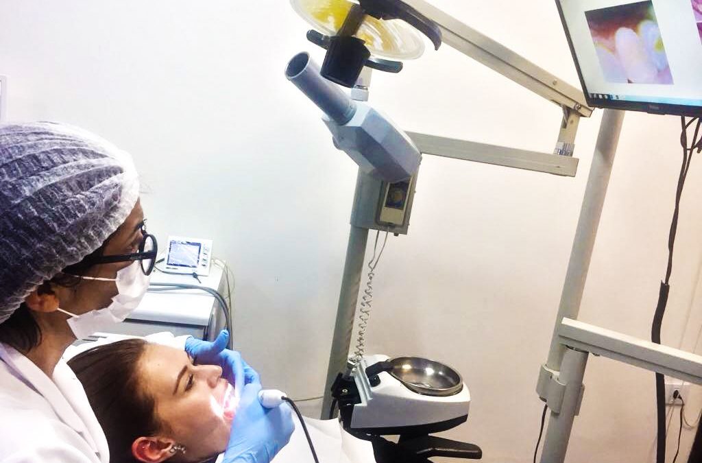 Checkup digital preventivo – Câmera intraoral
