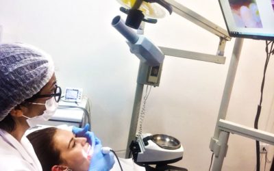 Checkup digital preventivo – Câmera intraoral
