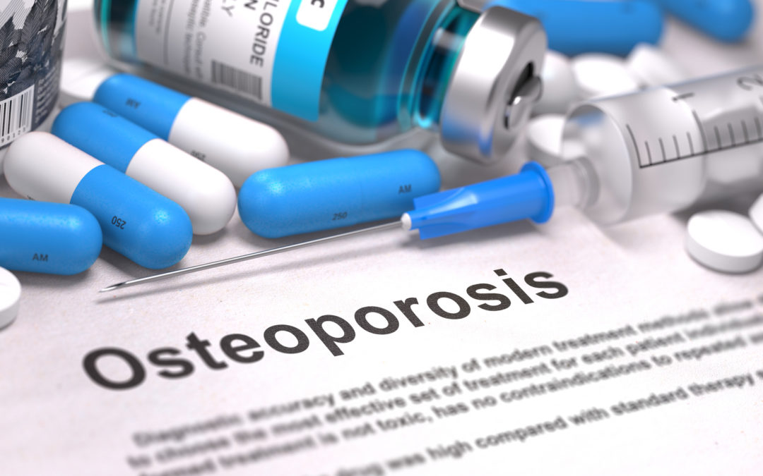 Medicamento para osteoporose X Implante dentário