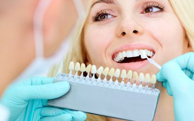 Quem Pode Fazer Clareamento Dentário?