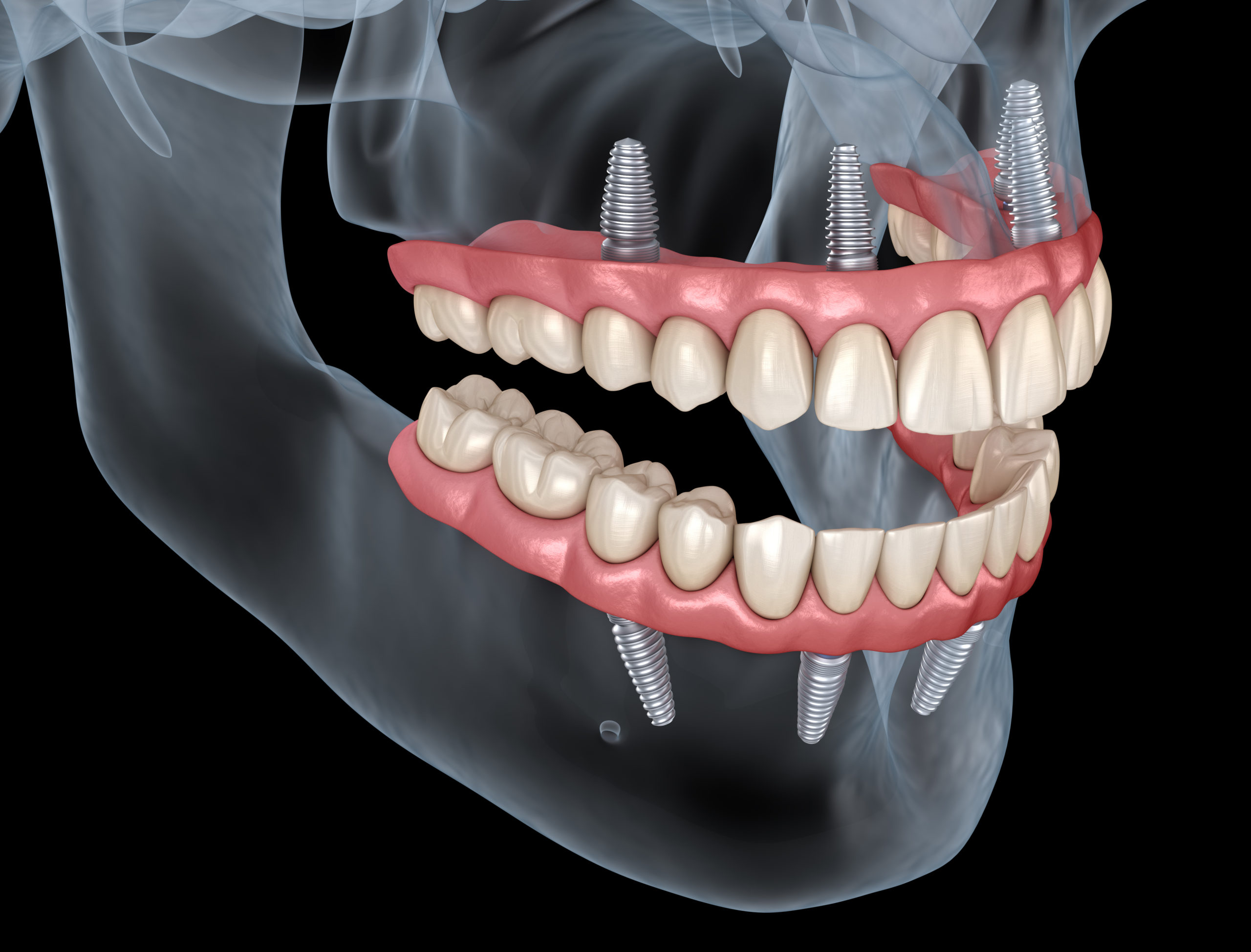 Protocolo dentário: como limpar?